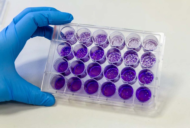 Mit einem Virus-Aktivitätstest lässt sich untersuchen, ob mit Lüftungsanlagen gefilterte Luft noch infektiöse und damit übertragbare Viren enthält.