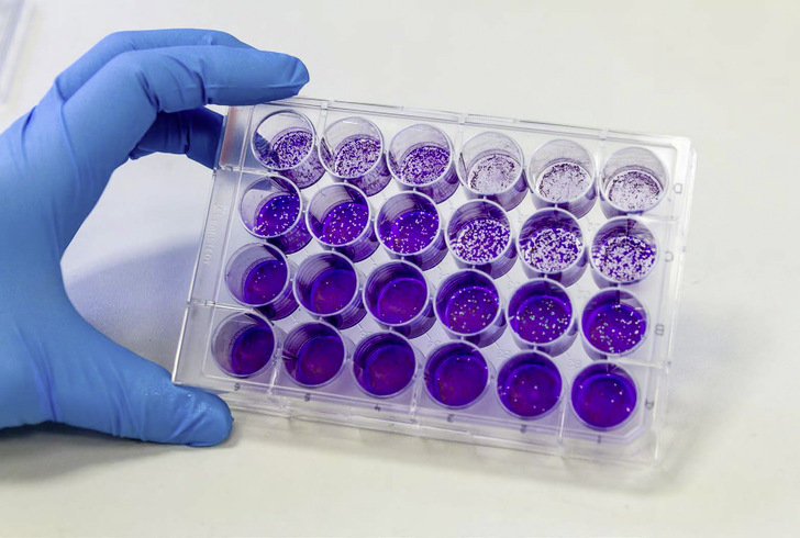 Mit einem Virus-Aktivitätstest lässt sich untersuchen, ob mit Lüftungsanlagen gefilterte Luft noch infektiöse und damit übertragbare Viren enthält.