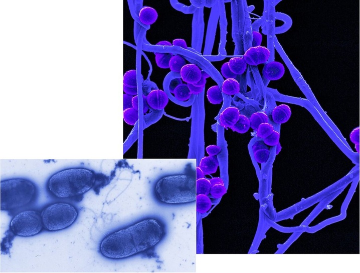 Im Helmholtz-Zentrum analysieren Forscher die Wirkungsweise vonBakterien und Viren auf das menschliche Immunsystem.
