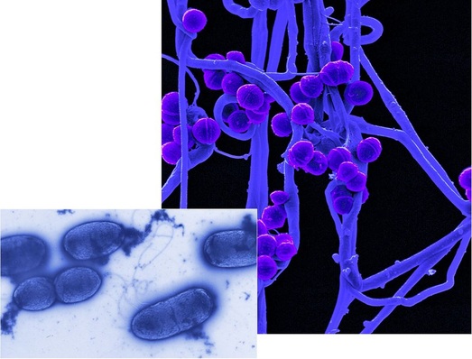 Im Helmholtz-Zentrum analysieren Forscher die Wirkungsweise vonBakterien und Viren auf das menschliche Immunsystem.