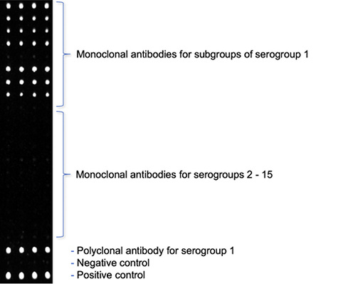 Mess-Chip weist Legionellen nach
